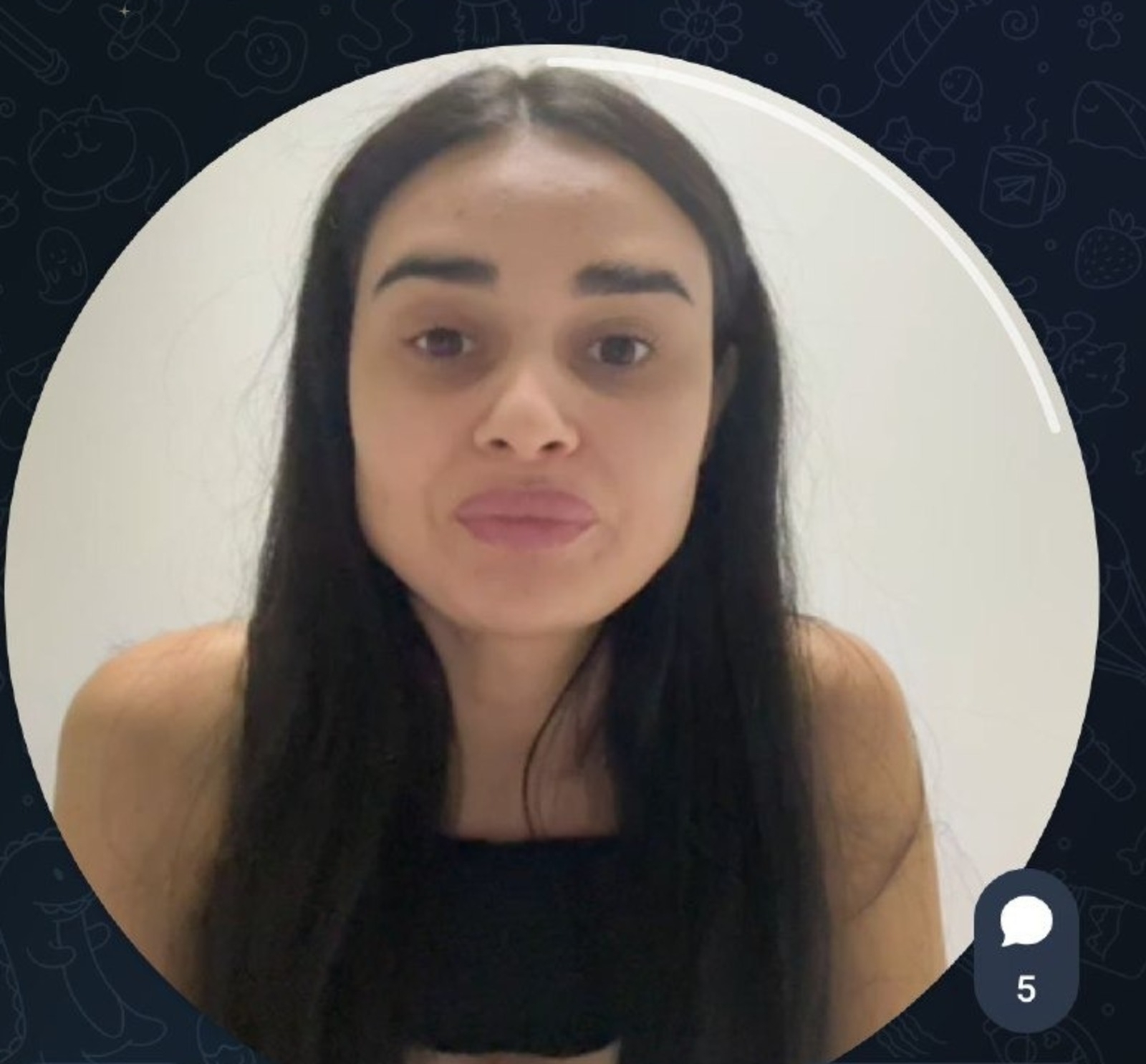 Гульназ Асаева сделала пластическую операцию